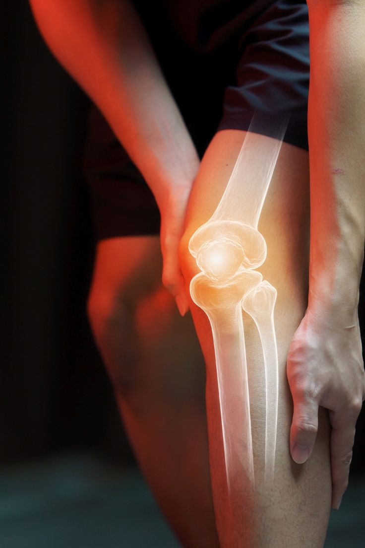 Dolor de rodillas y articulaciones: causas, síntomas y remedios naturales que realmente funcionan7